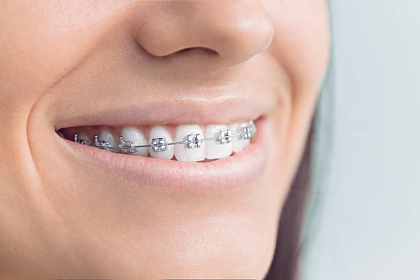 Laser Dentistry in Sidney, OH